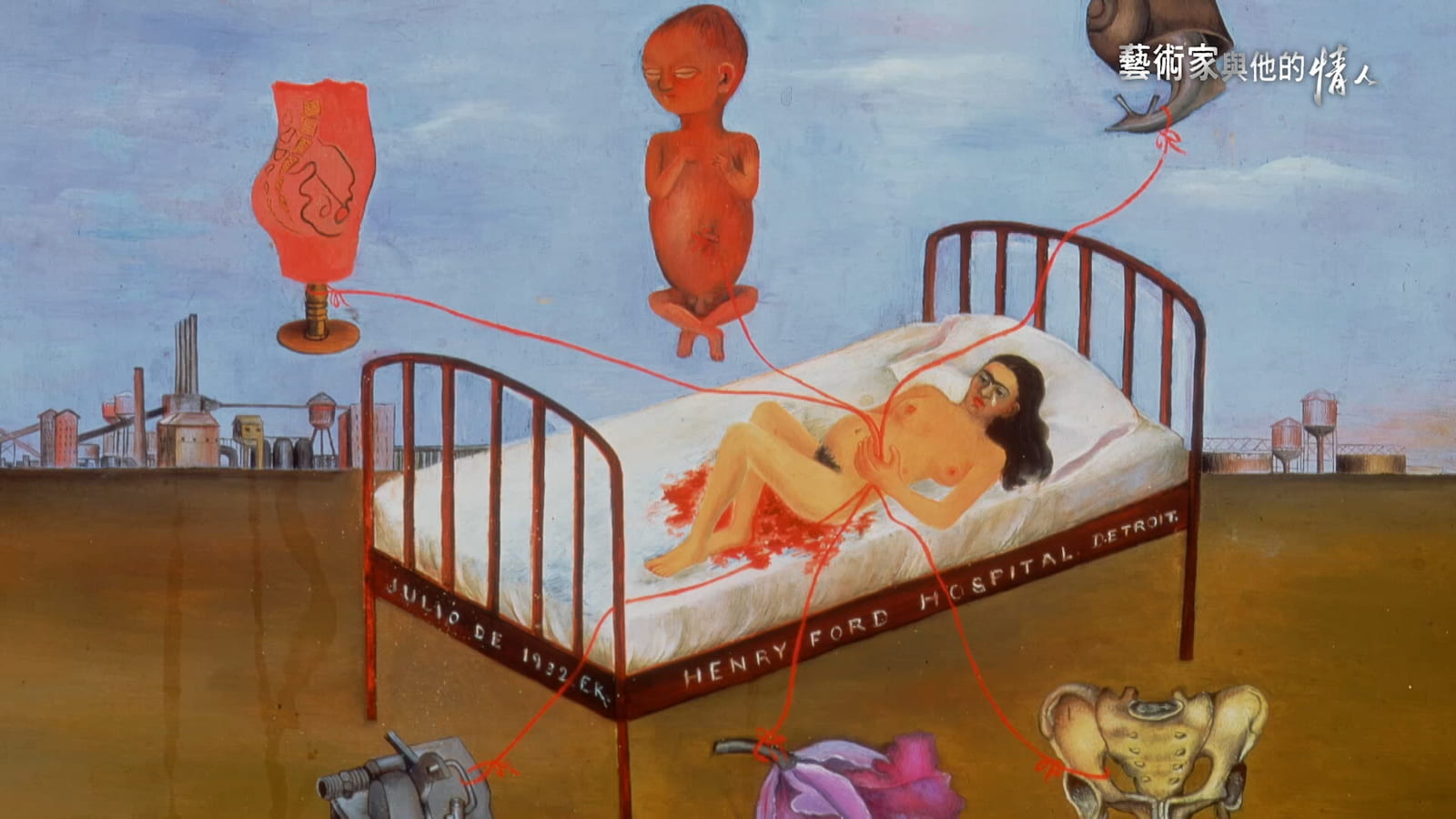 芙烈達卡羅將終身不孕的痛苦表達在畫作中。圖／《藝術家與他的情人》